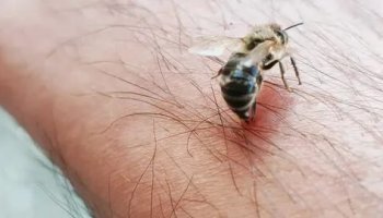 Звуки укуса