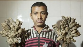 Звуки мутаций