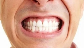 Звуки скрежета зубов