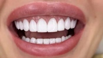 Звуки зубов