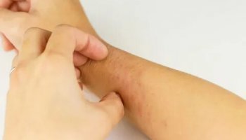 Звуки чесания